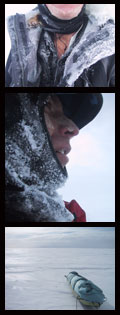 frostbite zone