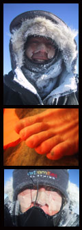 cold struggles