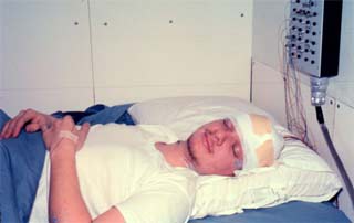 dreaming of freshies Fred Walton undergoing the sleep study